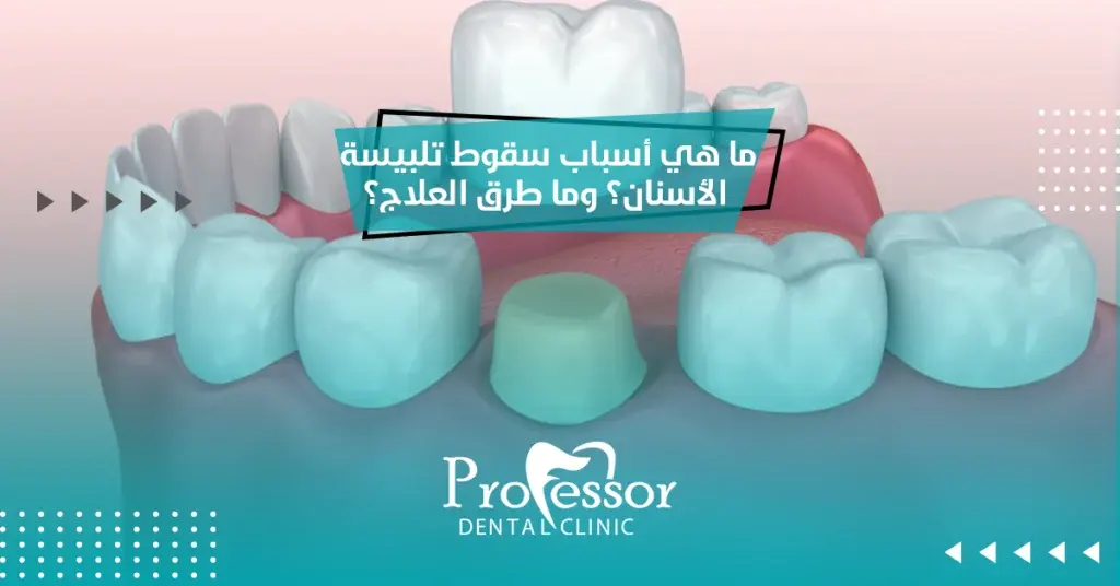 ما هي أسباب سقوط تلبيسة الأسنان؟ وما طرق العلاج؟