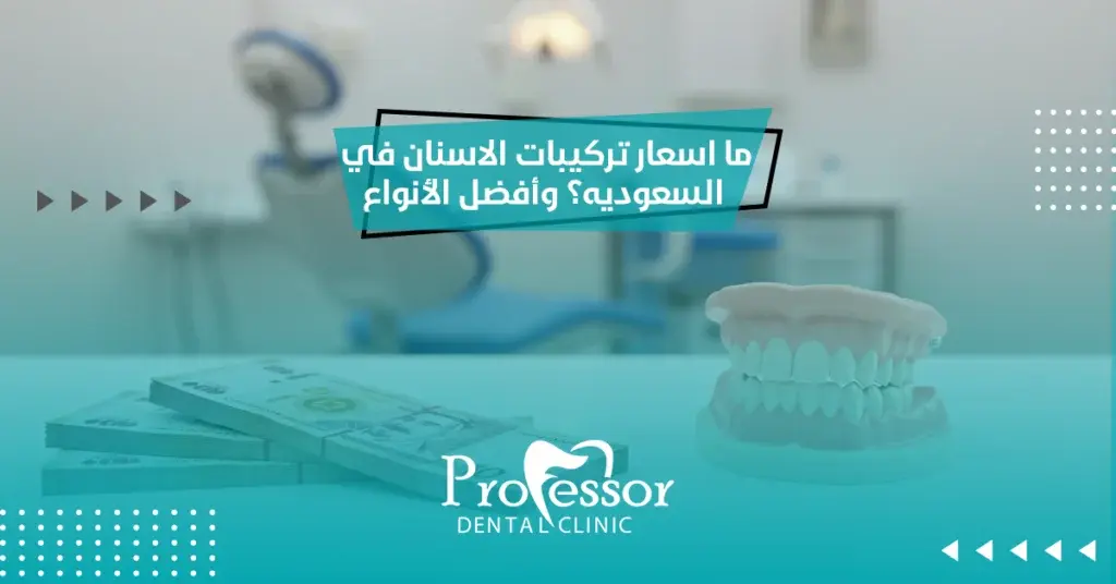 ما اسعار تركيبات الاسنان في السعوديه​؟ وأفضل الأنواع