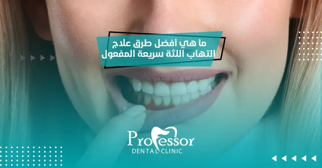 علاج التهاب اللثة