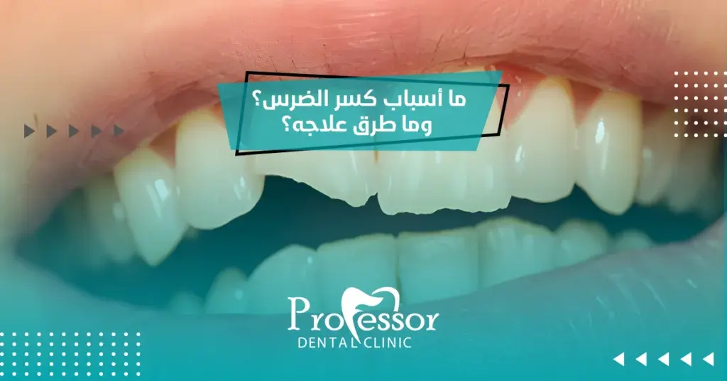 كسر الضرس