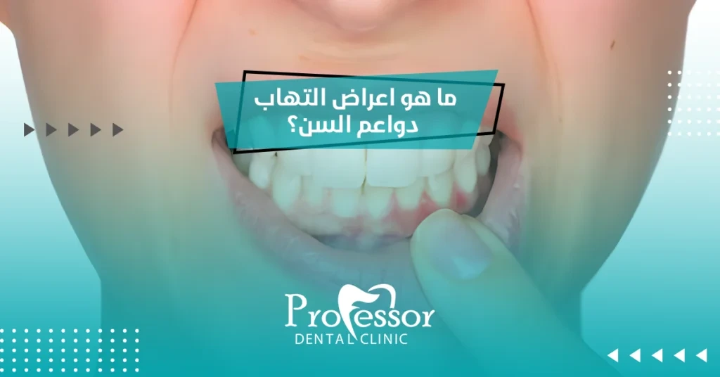 ما هي اعراض التهاب دواعم السن​؟