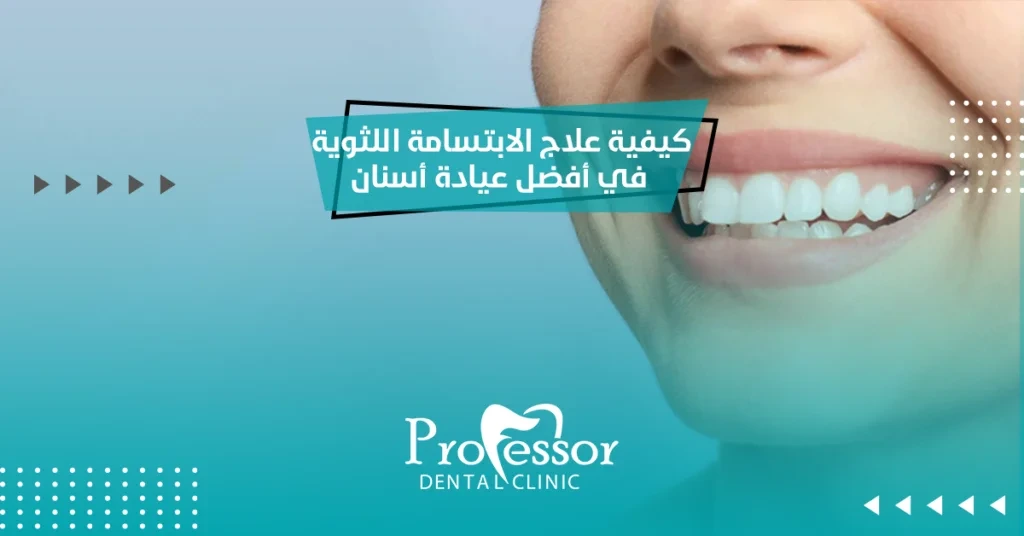 الابتسامة اللثوية