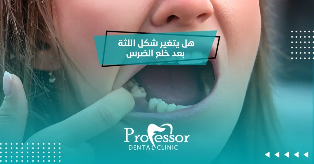 شكل اللثة بعد خلع الضرس