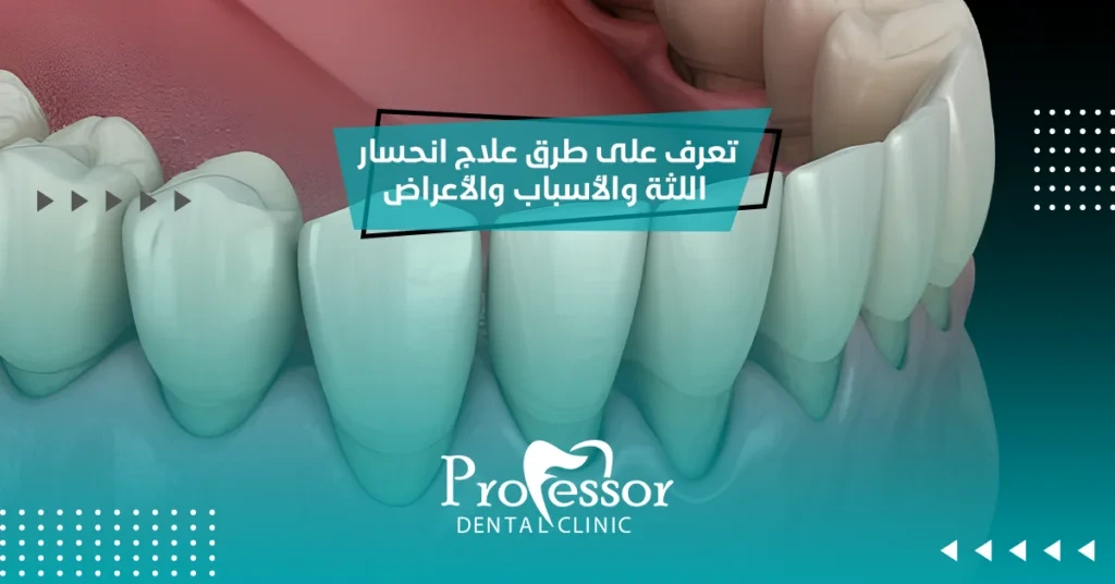 علاج انحسار اللثة