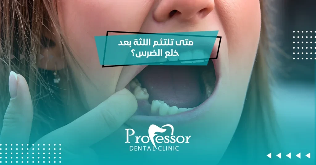 متى تلتئم اللثة بعد خلع الضرس
