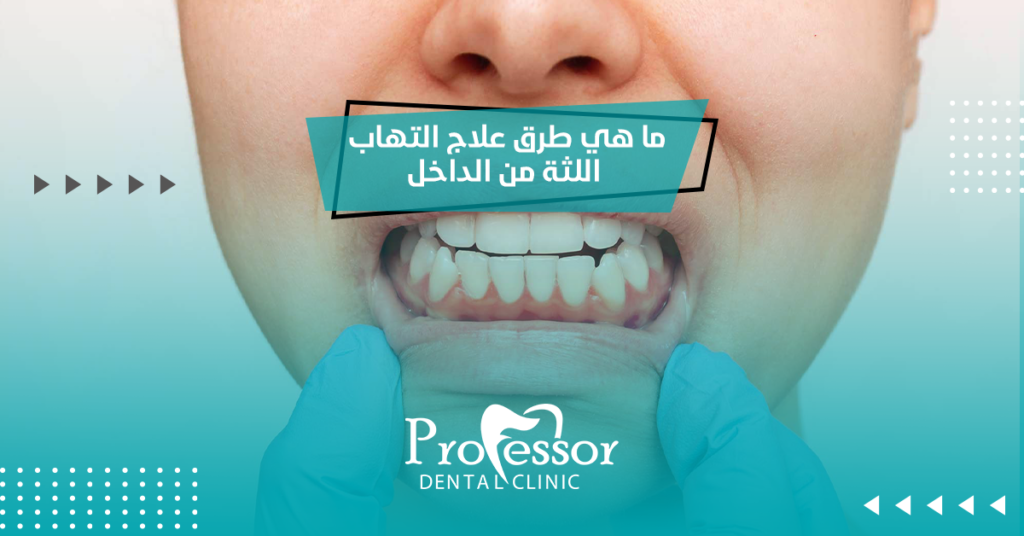 علاج التهاب اللثة من الداخل