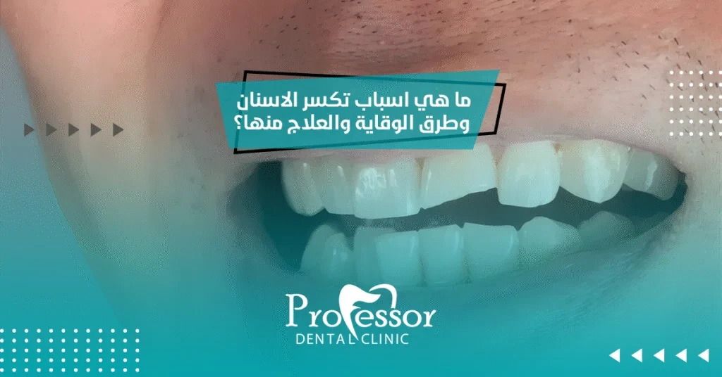 ما هي اسباب تكسر الاسنان وطرق الوقاية والعلاج منها؟