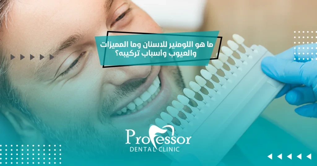 ما هو اللومينير للاسنان وما المميزات والعيوب وأسباب تركيبه؟