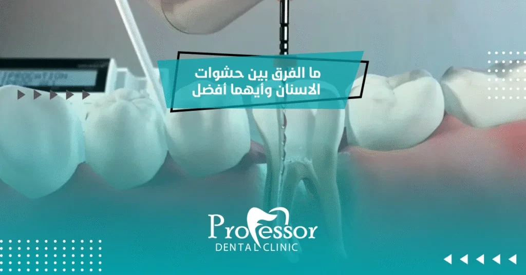 ما الفرق بين حشوات الاسنان وأيهما أفضل؟