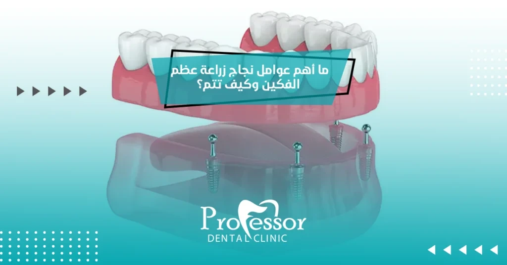 ما أهم عوامل نجاج زراعة عظم الفكين وكيف تتم؟