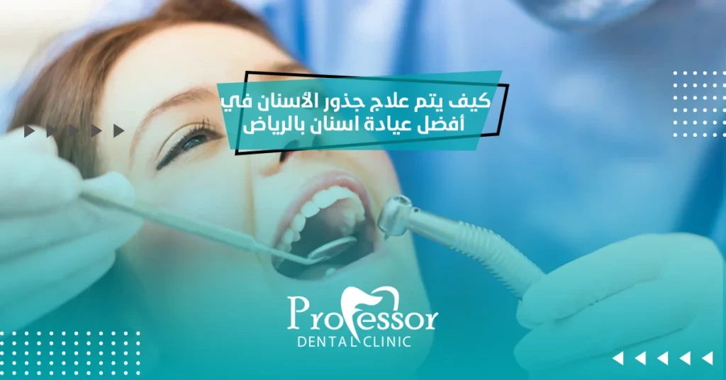 علاج جذور الاسنان
