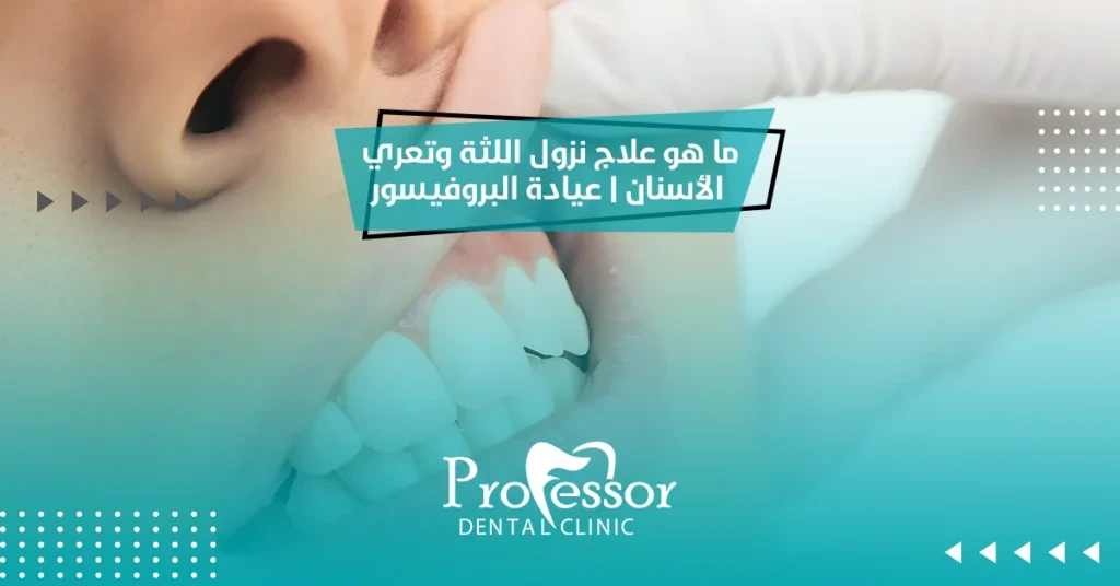 علاج نزول اللثة وتعري الأسنان