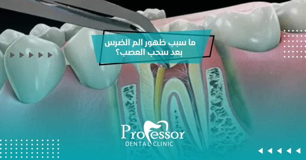 ما سبب ظهور الم الضرس بعد سحب العصب؟