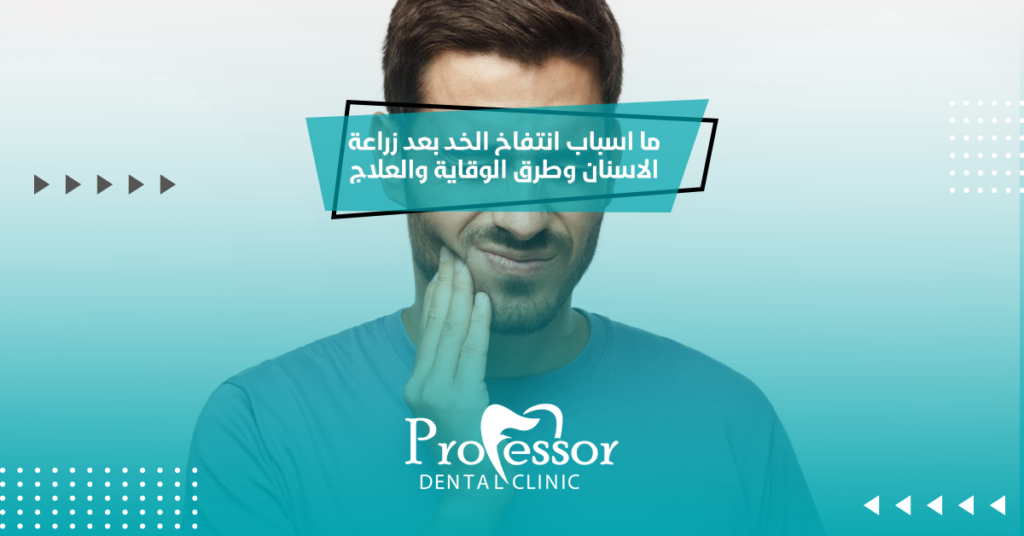 انتفاخ الخد بعد زراعة الاسنان