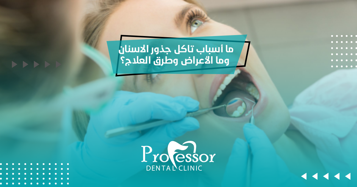 ما أسباب تاكل جذور الاسنان وما الأعراض وطرق العلاج؟