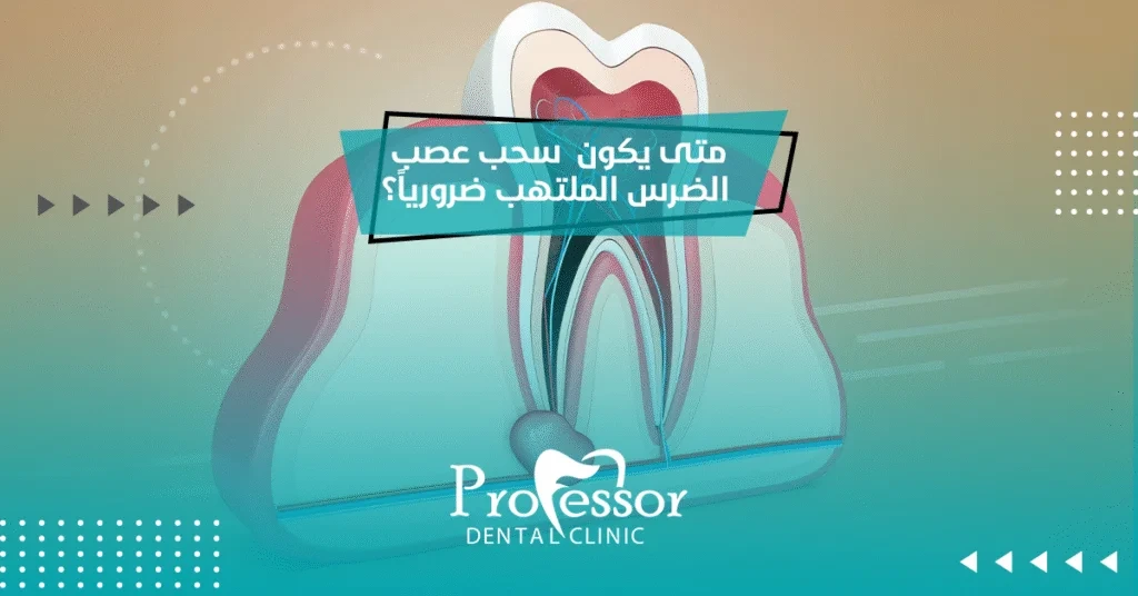 متى يكون سحب عصب الضرس الملتهب ضرورياً؟