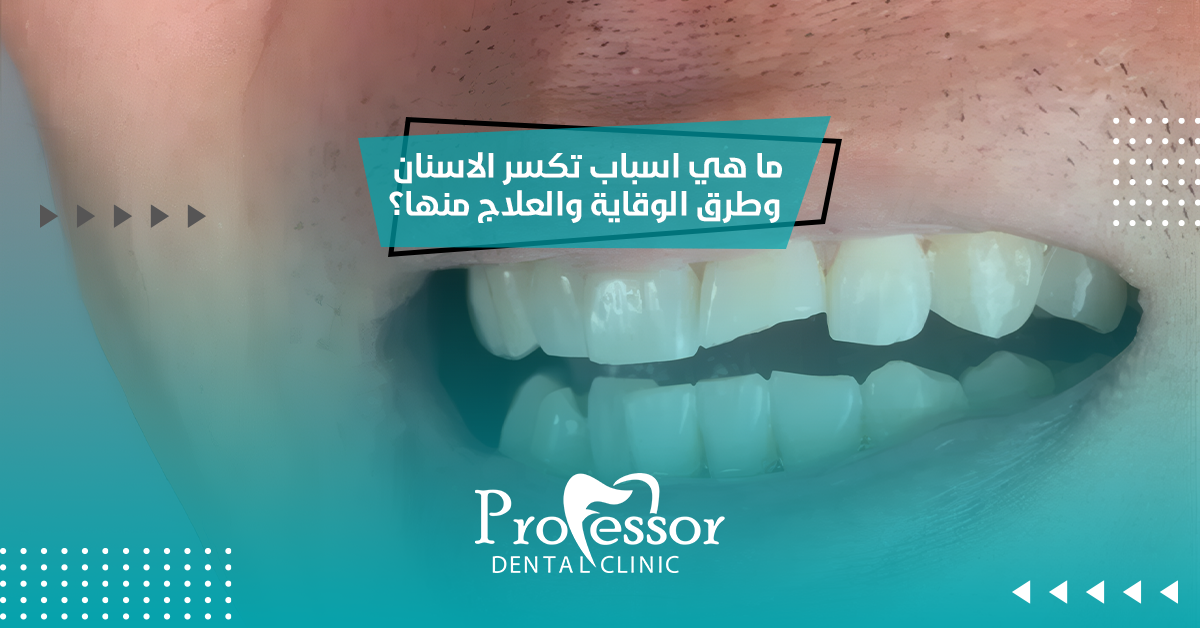 ما هي اسباب تكسر الاسنان وطرق الوقاية والعلاج منها؟