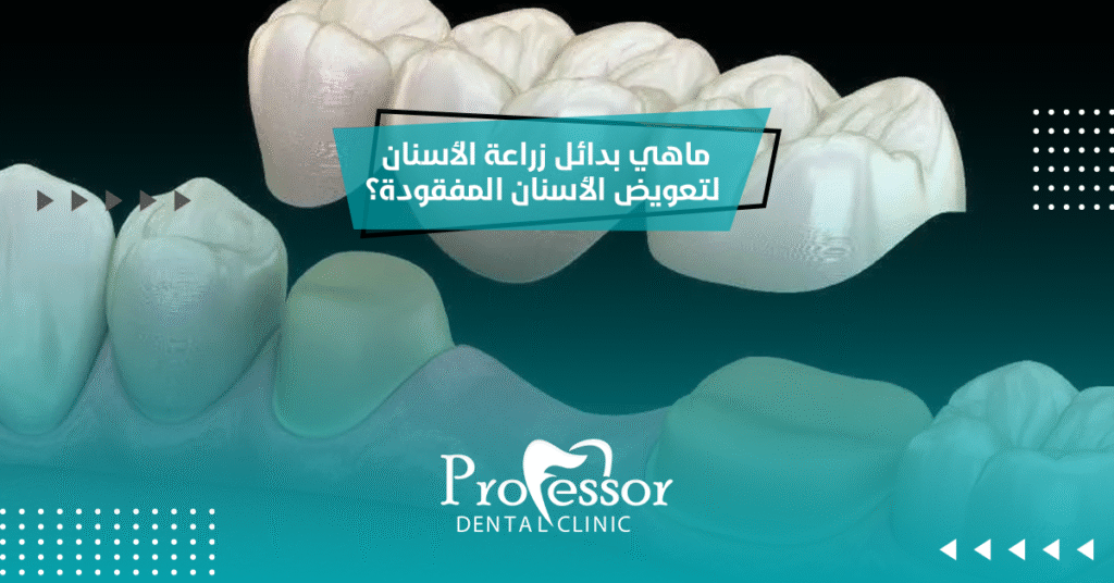 بدائل زراعة الأسنان