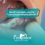 خراج الأسنان الداخلي