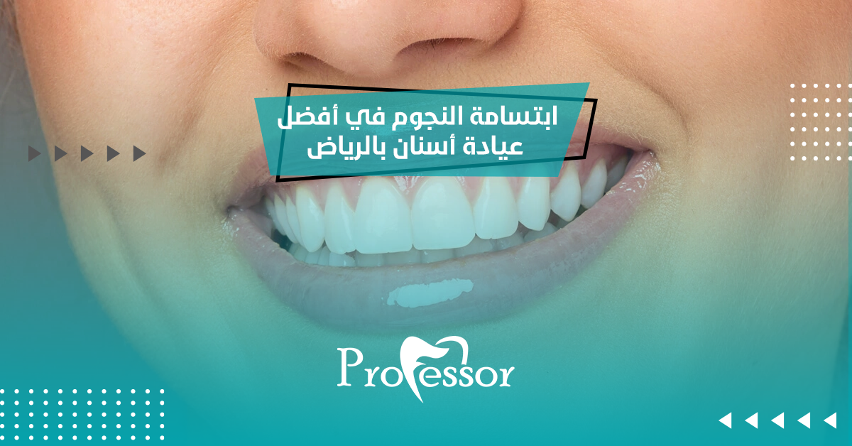 ابتسامة النجوم في أفضل عيادة أسنان بالرياض