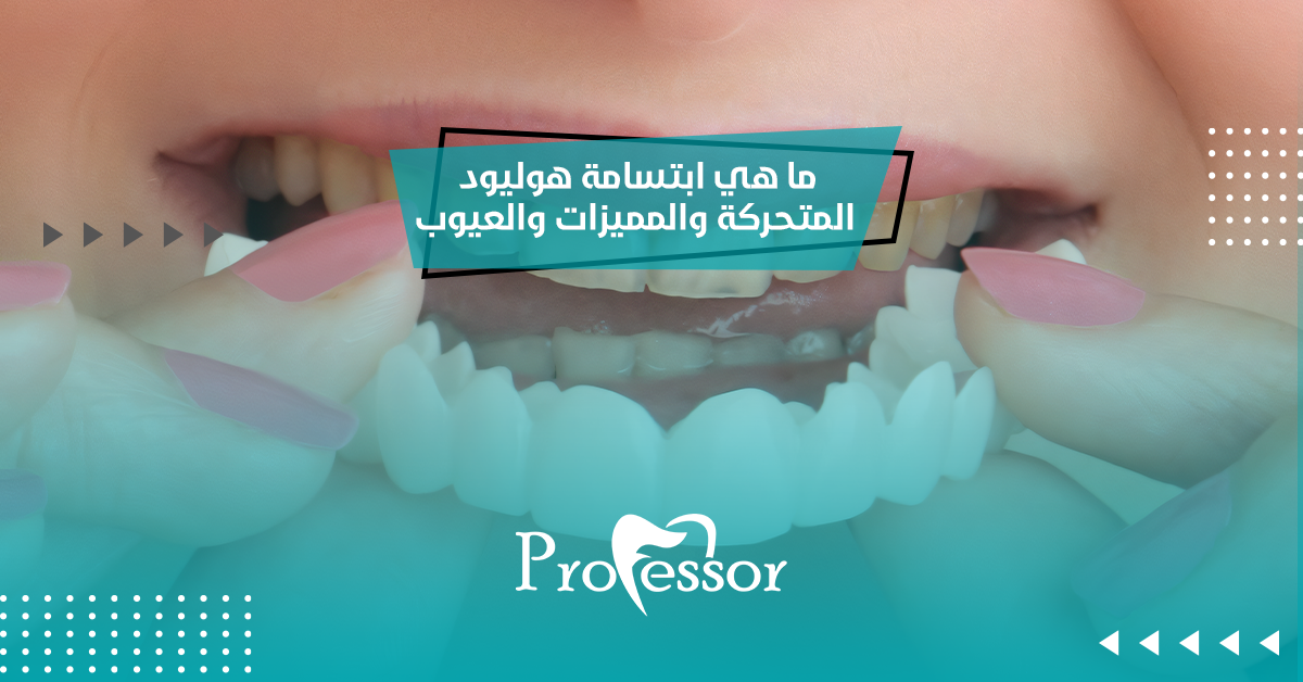 ما هي ابتسامة هوليود المتحركة والمميزات والعيوب؟