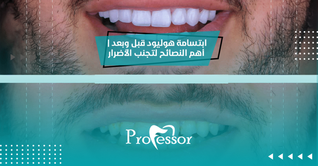 ابتسامة هوليود قبل وبعد