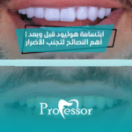 ابتسامة هوليود قبل وبعد