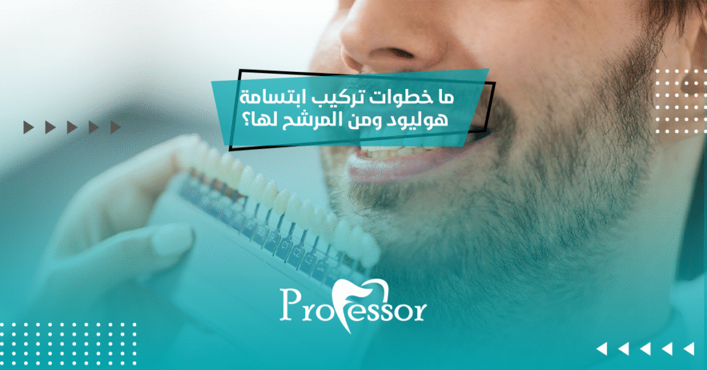 تركيب ابتسامة هوليود