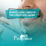 تركيب ابتسامة هوليود