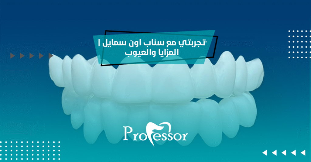 سناب اون سمايل