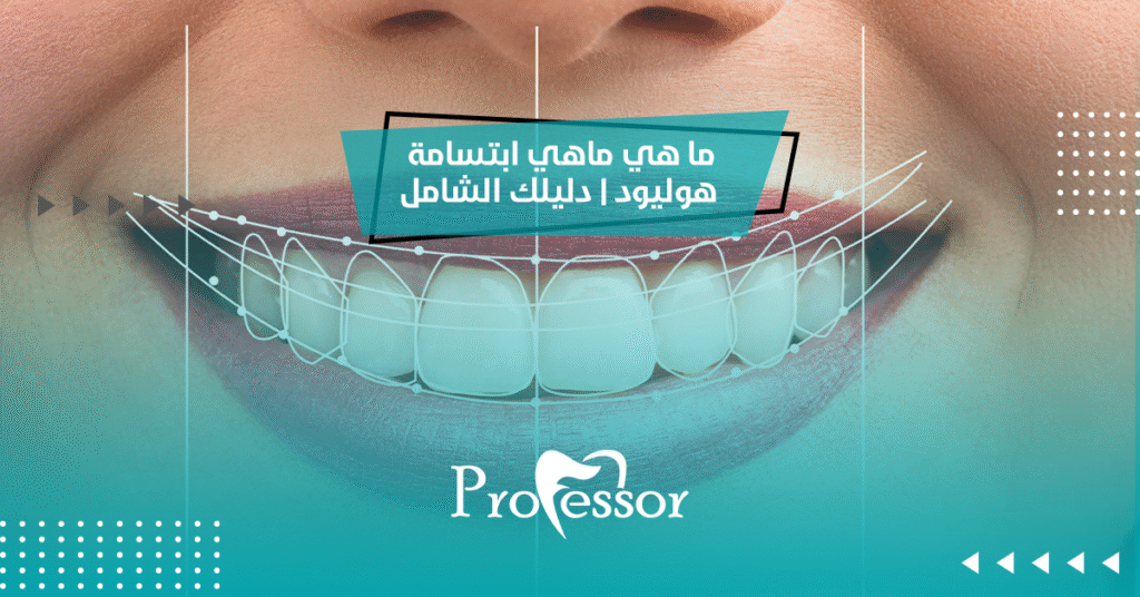ماهي ابتسامة هوليود