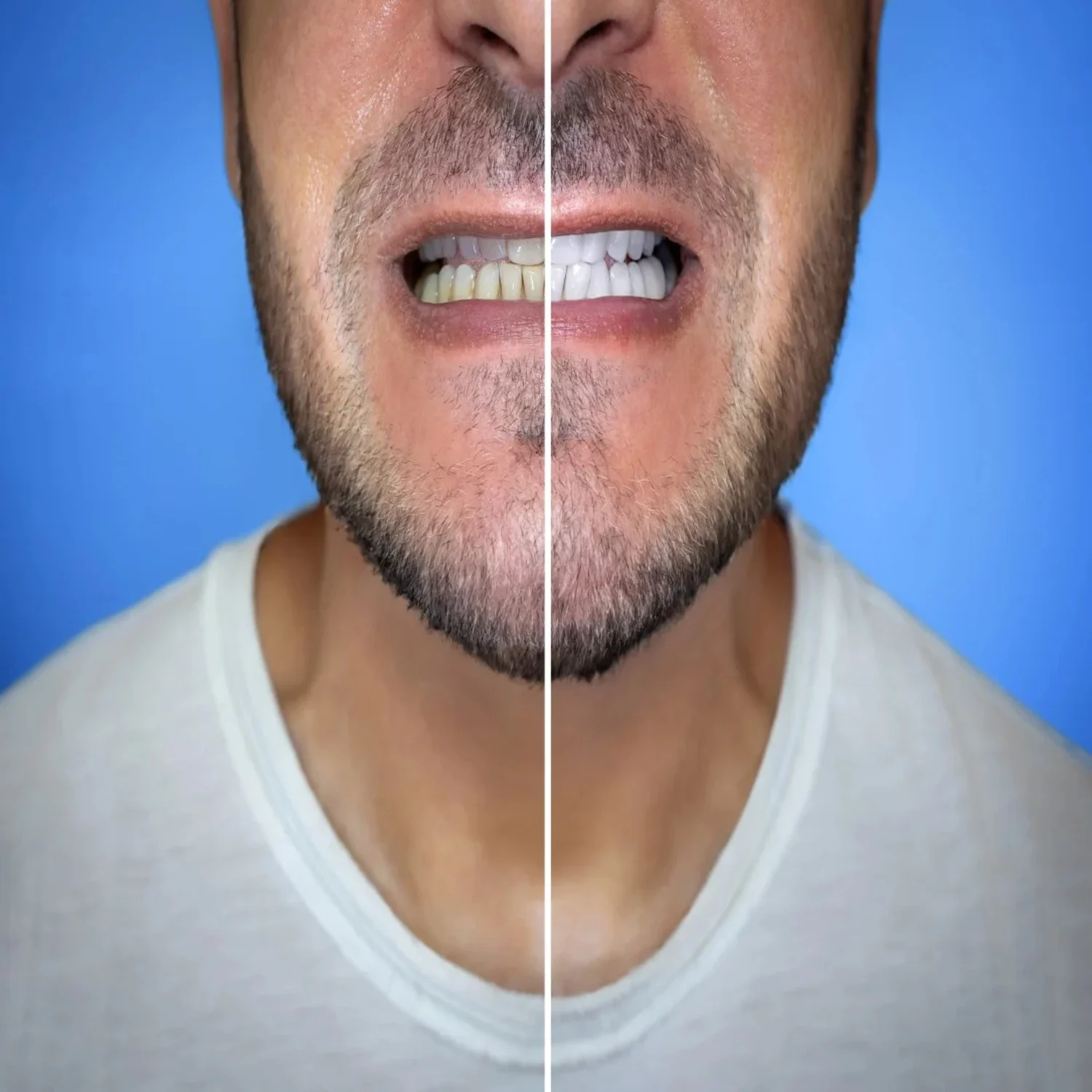 Before & After2