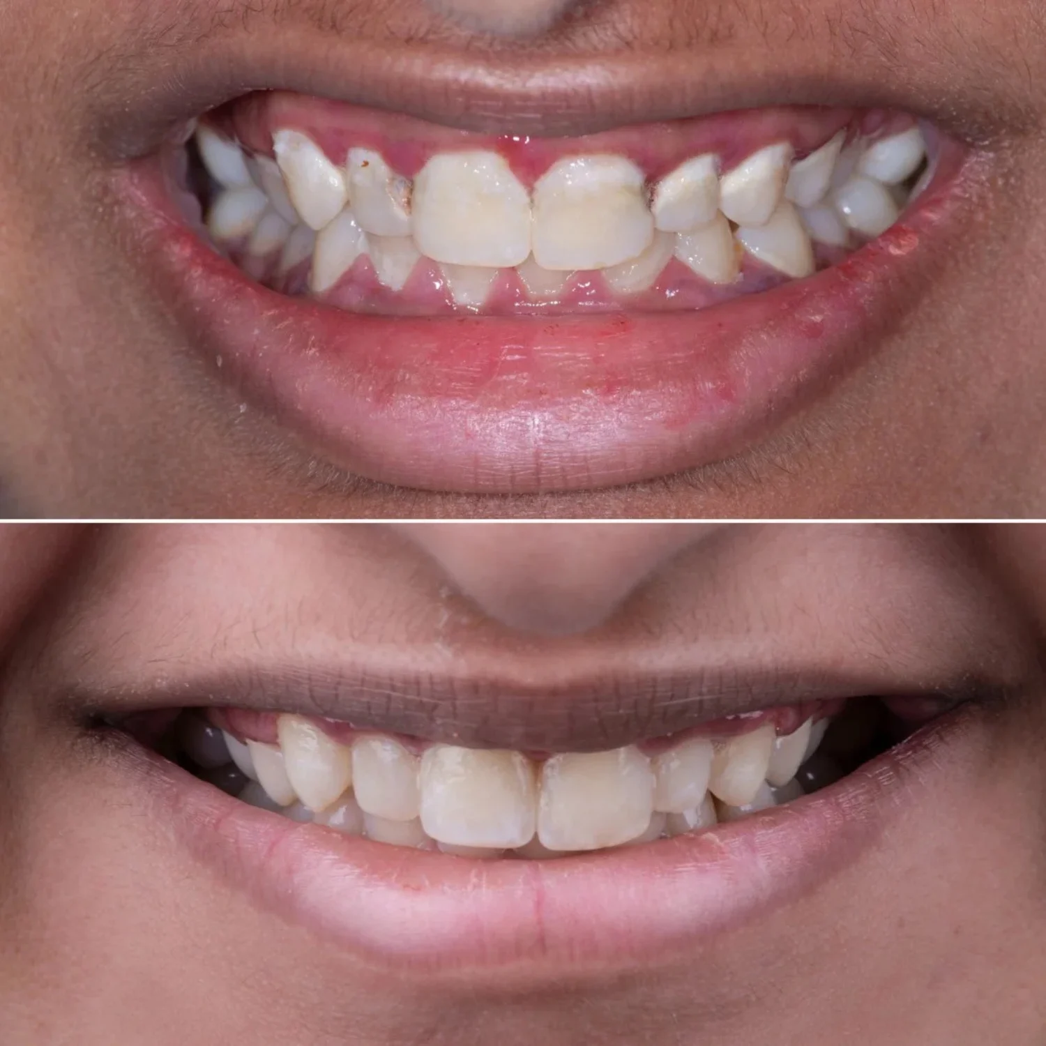 Before & After3