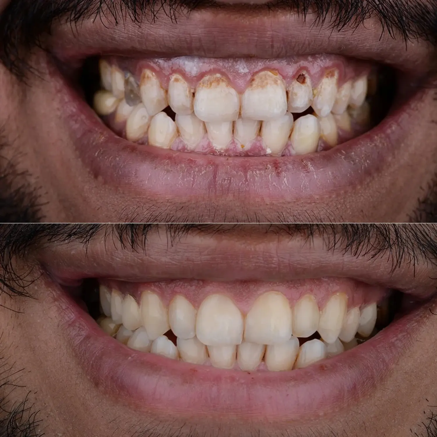 Before & After4