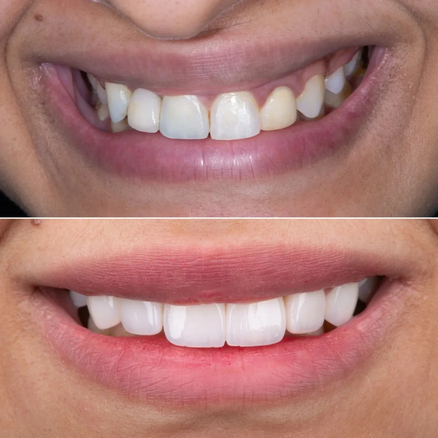 Before&After