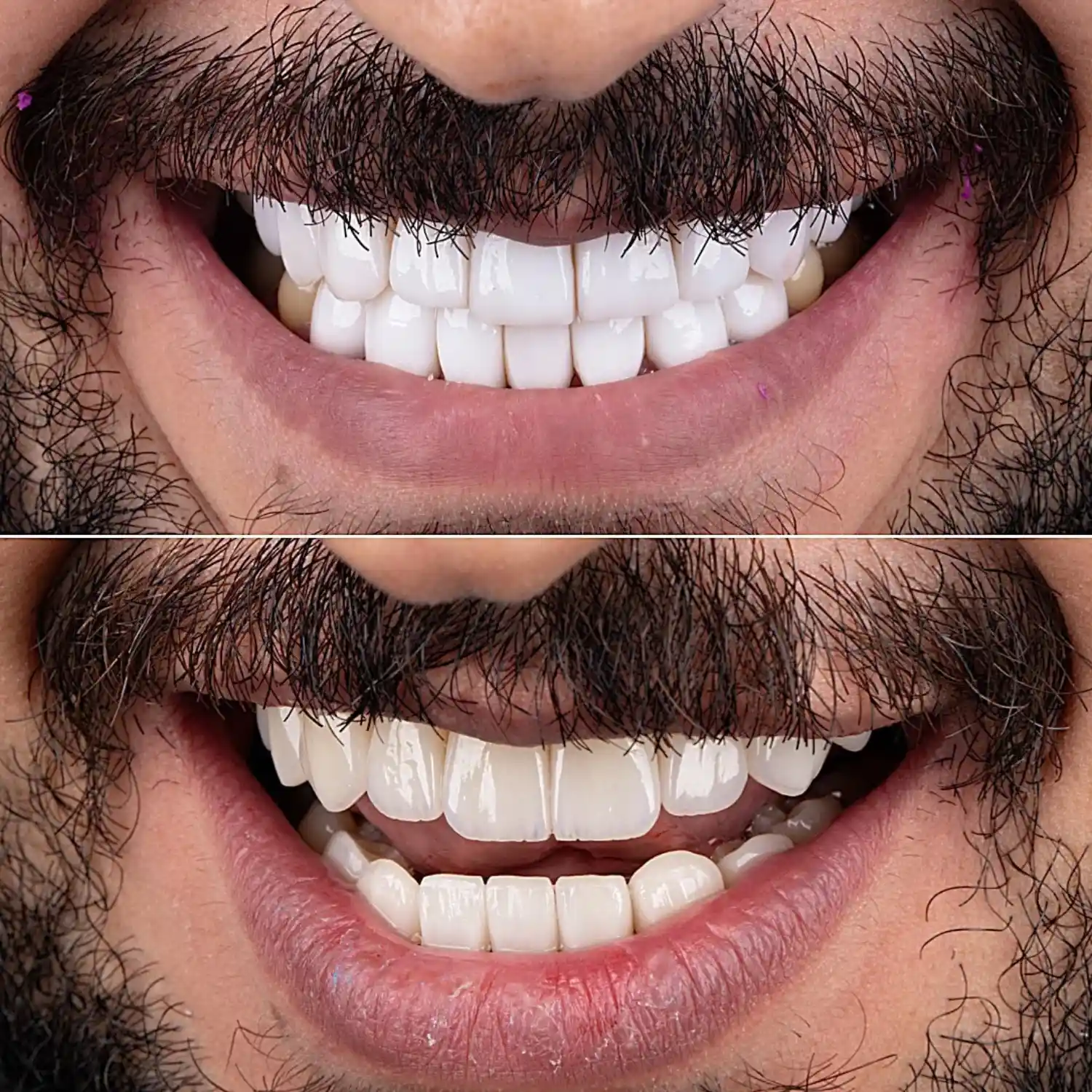 Before&After1