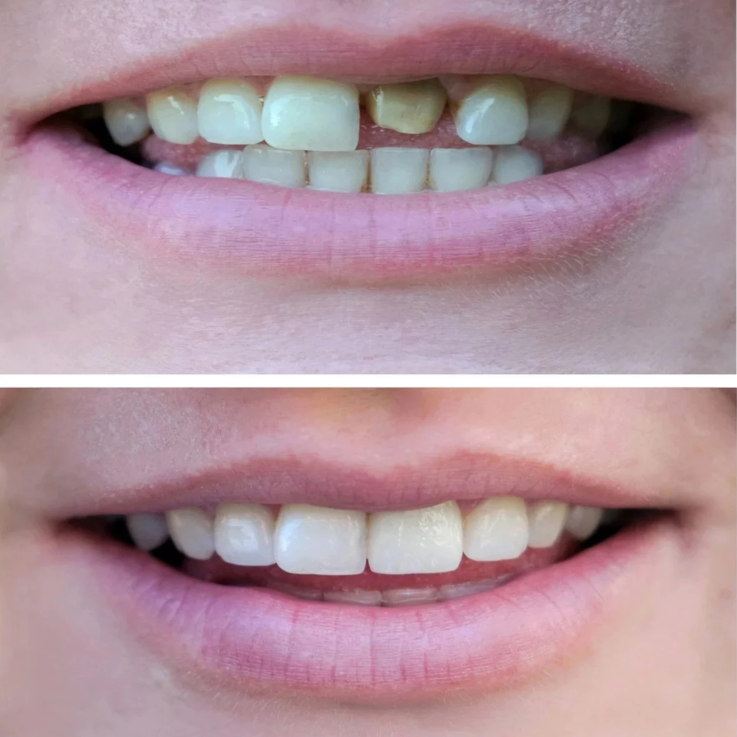 Before&After2