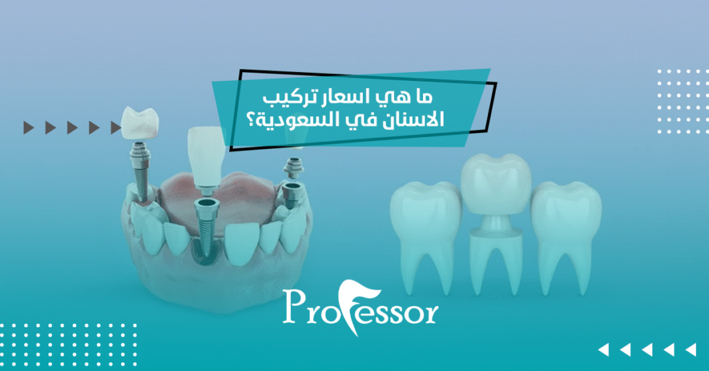 اسعار تركيب الاسنان