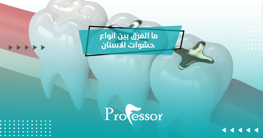 انواع حشوات الاسنان