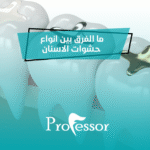 انواع حشوات الاسنان
