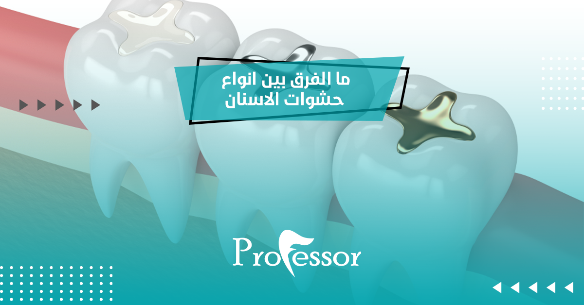 ما الفرق بين انواع حشوات الاسنان؟