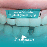 تركيب الاسنان الامامية