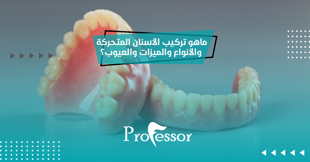 ماهو تركيب الاسنان المتحركة والأنواع والميزات والعيوب؟