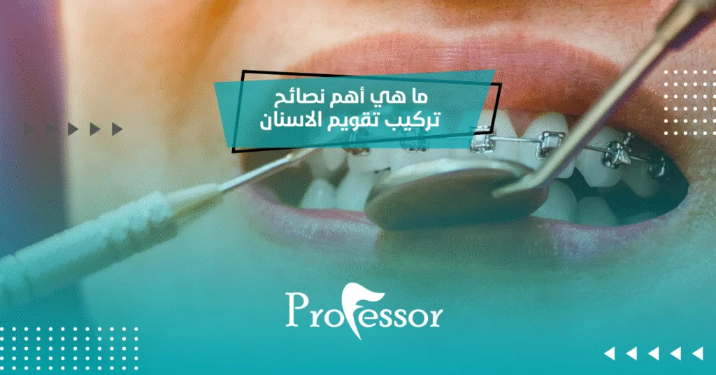 ما هي أهم نصائح تركيب تقويم الاسنان؟
