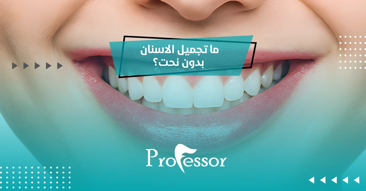 ما تجميل الاسنان بدون نحت؟