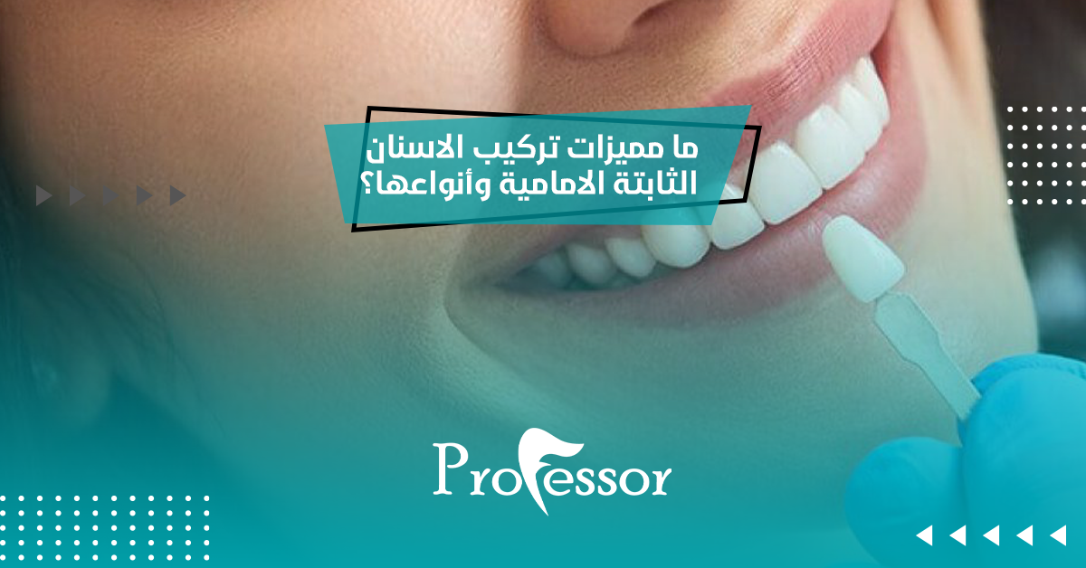 تركيب الاسنان الثابتة الامامية