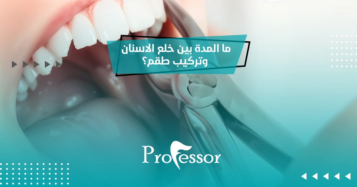 ما المدة بين خلع الاسنان وتركيب طقم؟