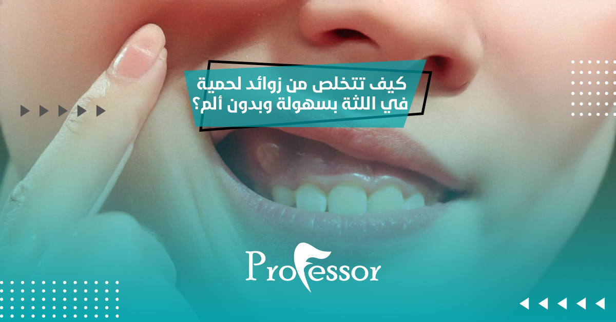 كيف تتخلص من زوائد لحمية في اللثة بسهولة وبدون ألم؟