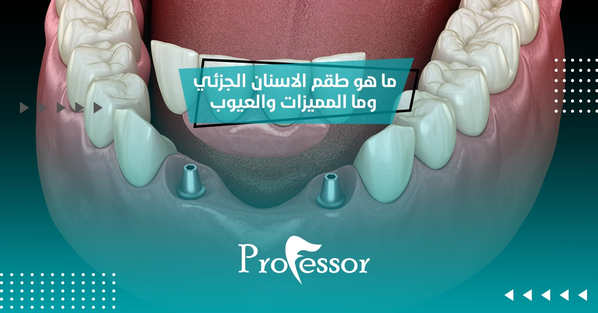 ما هو طقم الاسنان الجزئي وما المميزات والعيوب 