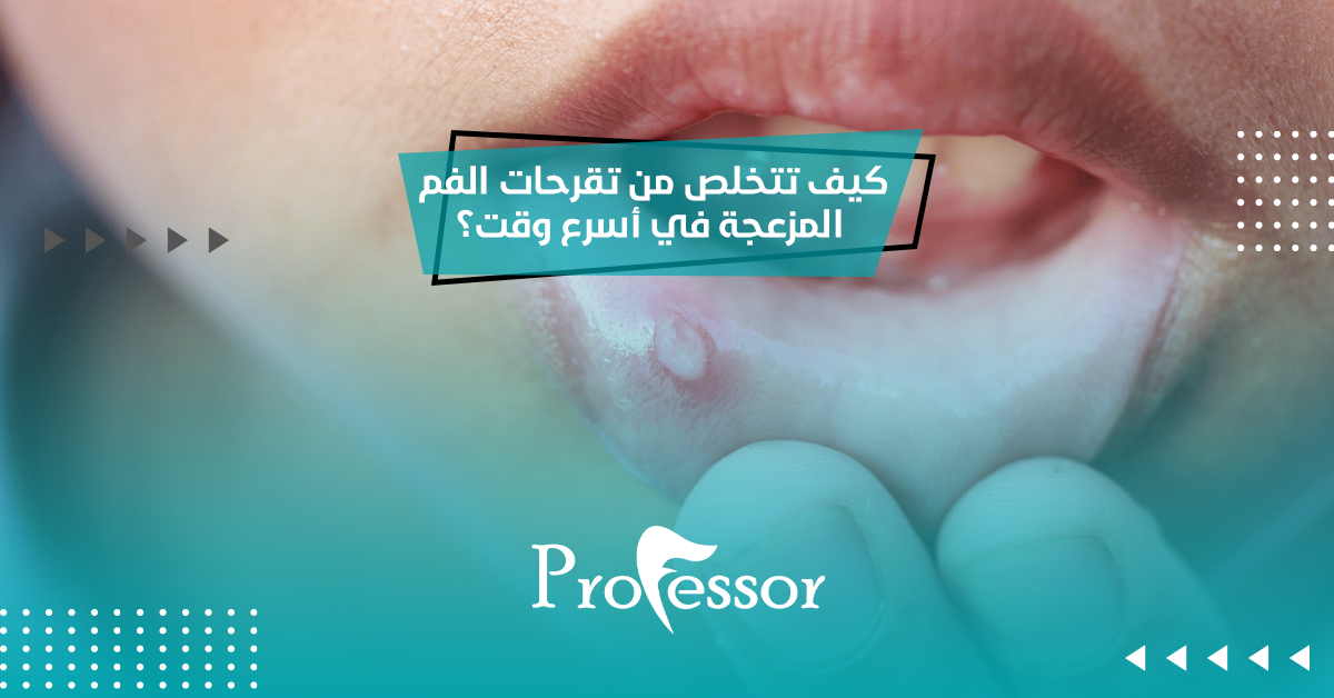 ما علاج تقرحات الفم​ المزعجة في أسرع وقت؟